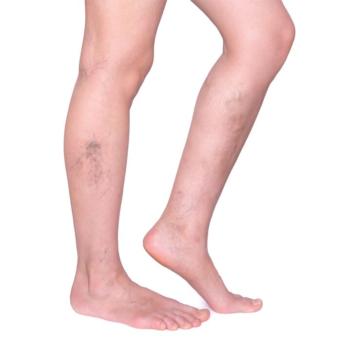 Original instructions for Vasaxal - Nabushhiy, convince veins on the legs
