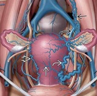 Change the structure of blood vessel walls