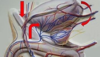 Varicocele in the pelvic vein
