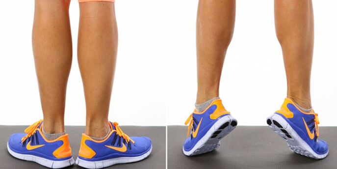 Gymnastics of varicose veins