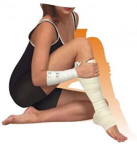 Other treatments for varicose veins